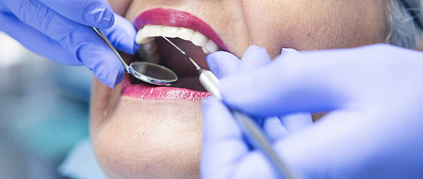 Best Emergency Dental Surgery in Kalona, IA